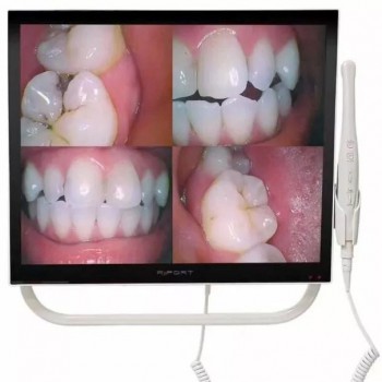 Magenta YFHD-D 歯科口腔内カメラ 1/4 ソニー CCD 17インチモニターとブラケット付き