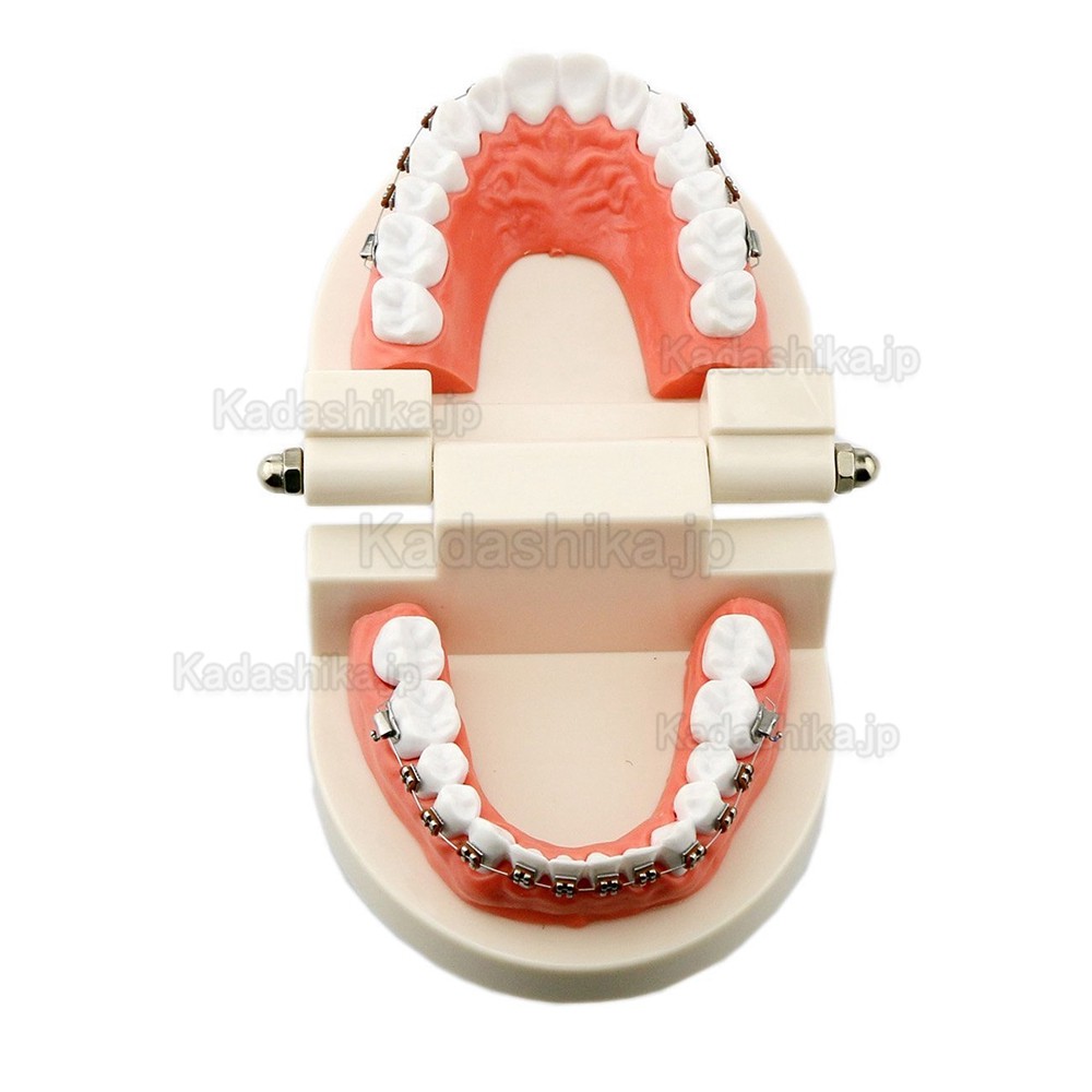 歯科 歯磨き指導顎模型（矯正）