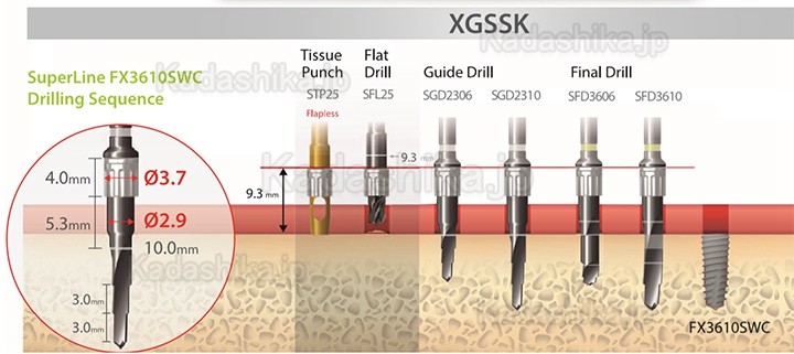 Dentium XGSSK デジタルガイド手術キット(シンプルキット) Dentium XGSSK デジタルガイド手術キット(シンプルキット)