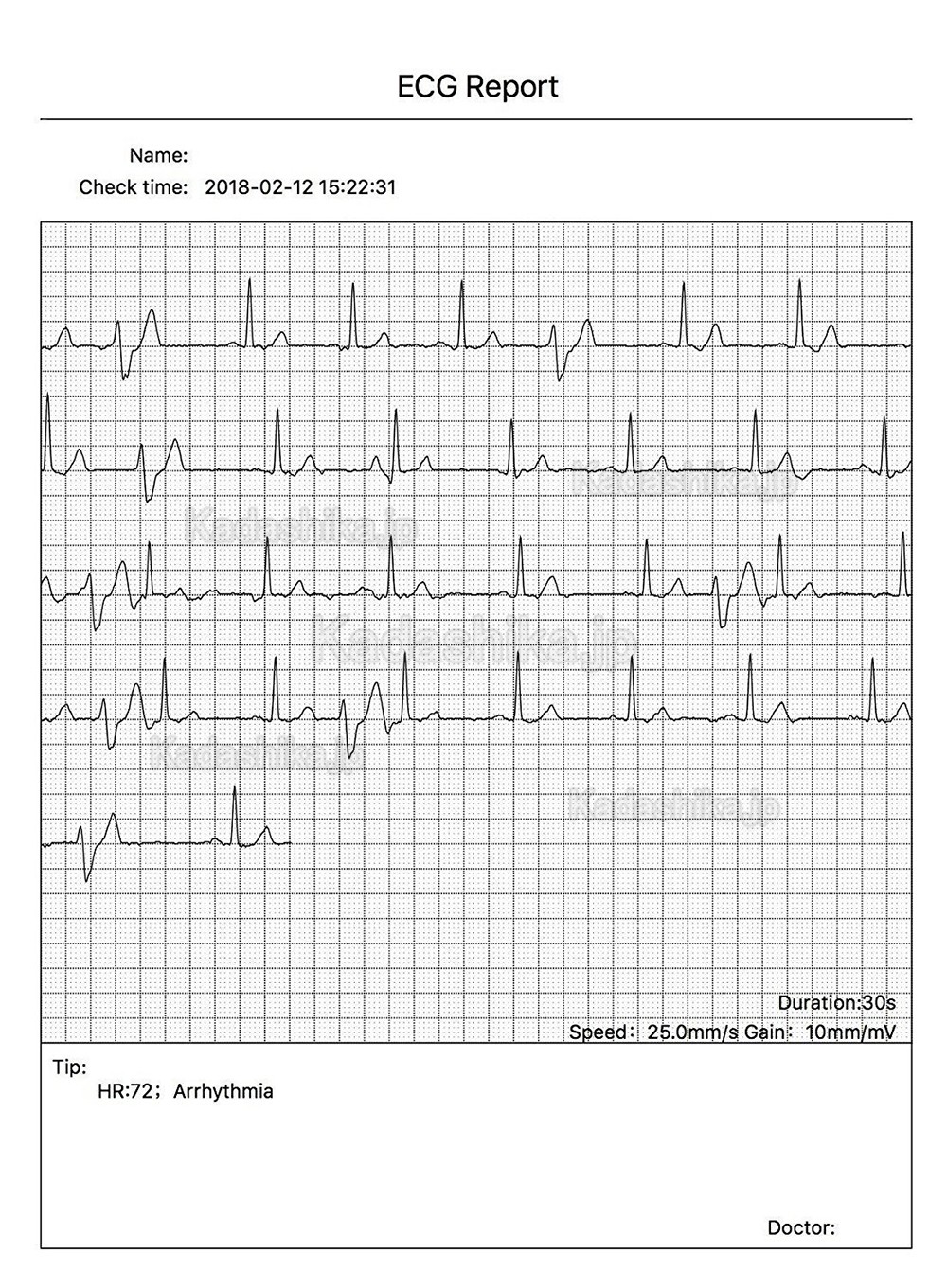 CONTEC PM10 家庭用 携帯型 心電計 ECG/EKGモニター CONTEC PM10 家庭用 携帯型 心電計 ECG/EKGモニター