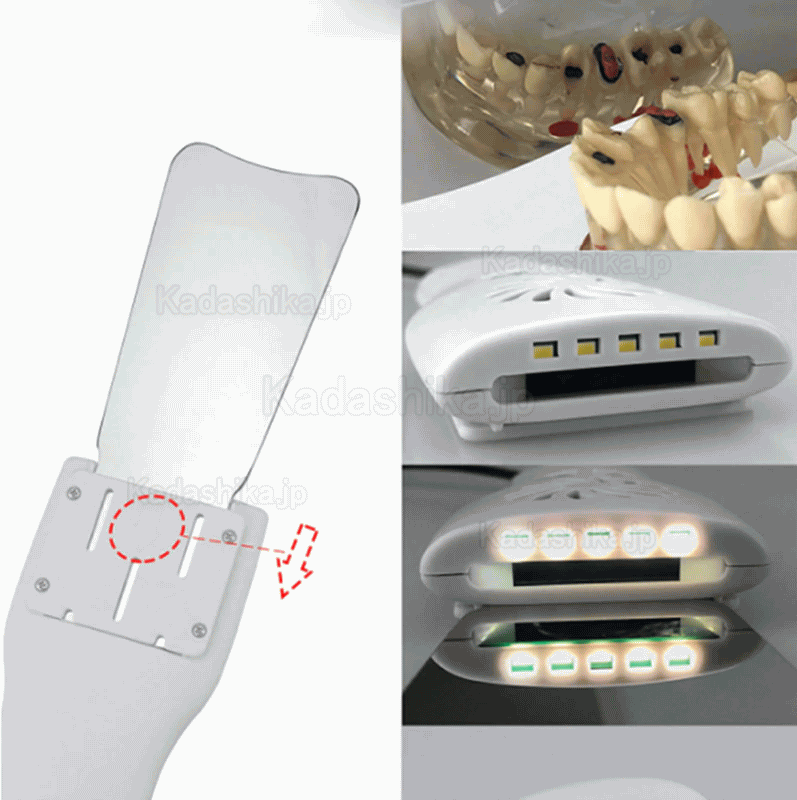歯科曇り止め口腔内撮影ミラーシステム 自動曇り防止イメージングミラー