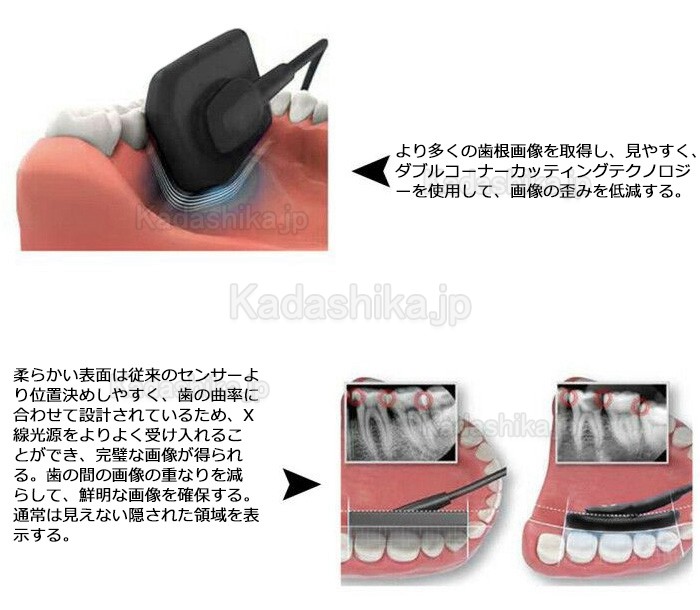 歯科用デジタルx線センサー CCDセンサー 歯科用デジタルx線センサー CCDセンサー