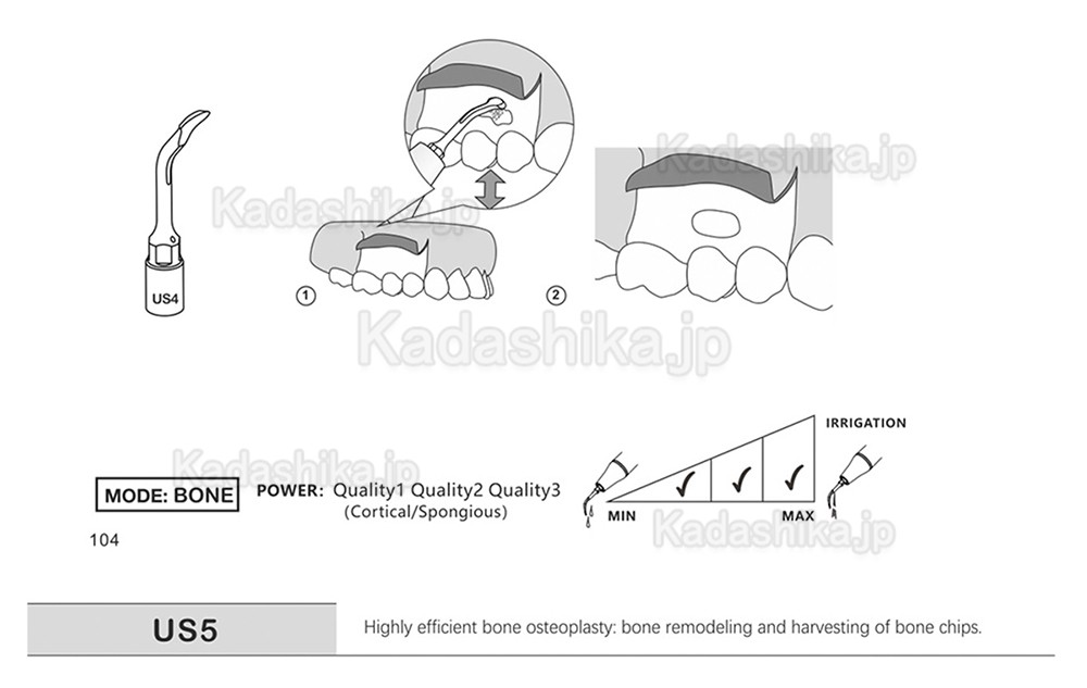 歯科ピエゾサージェリーチップ US1 US1L US1R US2 US3 US4 US5 US6 US7 US11 US12 (Mectron Woodpeckerに適用)