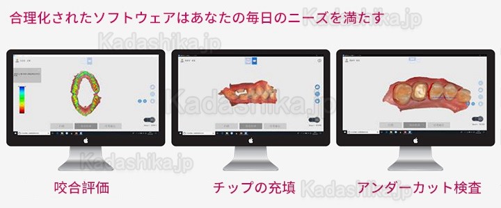 Runyes 3DS 歯科 口腔内スキャナー 3dスキャナー パウダーレスリアルカラースキャン
