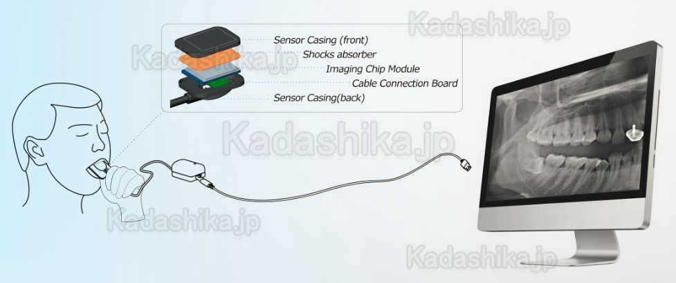 歯科X線センサー CCDセンサー USB デジタル口腔内センサー + 500シース 歯科X線センサー CCDセンサー USB デジタル口腔内センサー + 500シース