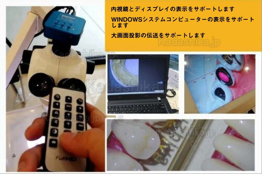 歯科用マイクロスコープ 3.75X-22.5X 歯医者顕微鏡 (カメラ付き、トロリータイプ) 歯科用マイクロスコープ 3.75X-22.5X 歯医者顕微鏡 (カメラ付き、トロリータイプ)