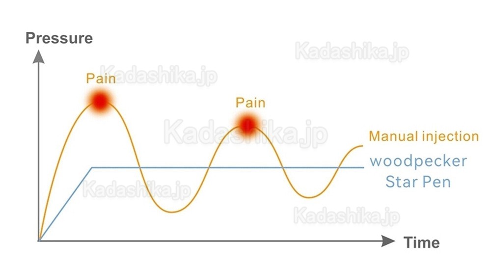 Woodpecker Star Pen 歯科用無痛麻酔装置 口腔局所麻酔システム 麻酔注射器