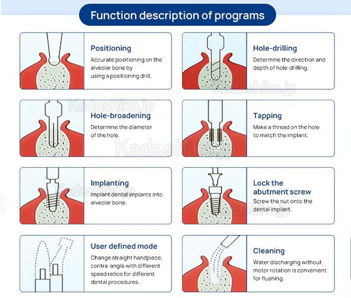 Yahope IMPLANT surg 歯科インプラントユニット/ インプラントモーター Yahope IMPLANT surg 歯科インプラントユニット/ インプラントモーター